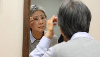 눈커풀 처지는 부모님…‘이 수술’ 받았더니