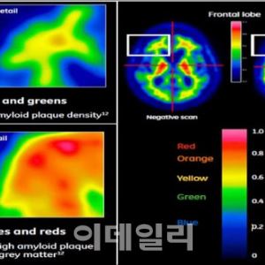 [진단 전성시대]K진단, 글로벌 경쟁력 만든 주역은? “의료인프라+IT기술 시너지”