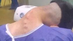 역대급 마약 부작용...목 흐늘흐늘하다 90도 ‘푹' 꺾여