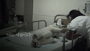6살에 '황산' 부은 그 놈, 기어서 도망친 아이 