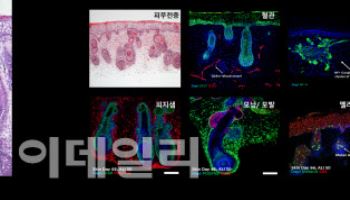 강스템바이오텍, 아토피 치료 조성물 특허 등록