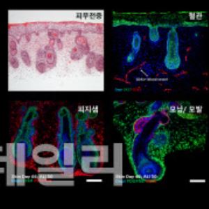 강스템바이오텍, 아토피 치료 조성물 특허 등록