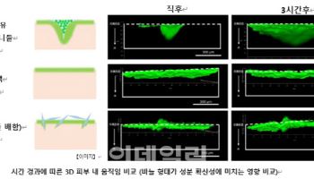 日다이쇼 “라파스 마이크로니들, 흡수율·확산성 확인”…日매출 날개단다