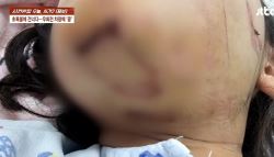 “어, 밟혔네?” 초등생 들이받은 80대 무면허 운전자