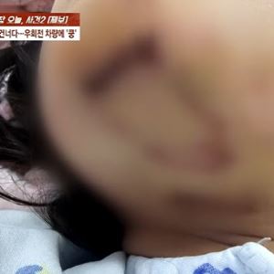 “어, 밟혔네?” 초등생 들이받은 80대 무면허 운전자