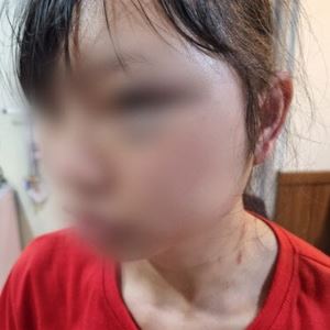 "맞아도 회사 다녀야"...여성 이주노동자 얼굴 걷어찬 40대, 결국