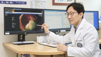 대장암 치료 첫 단계, '정확한 내시경 검사'가 중요해