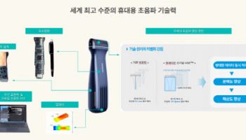 "글로벌 최초 휴대용 무선 초음파기기 상용화 기술 보유"[힐세리온 대해부②]