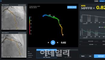 메디픽셀, 심근 FFR AI ‘MPFFR-1000’ 식약처 허가 획득
