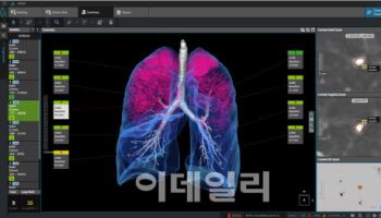 코어라인소프트, 佛폐암검진사업 단독공급사 선정…10兆시장 공략 청신호