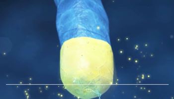 젬백스 GV1001, 알츠하이머 임상2상 결과 앞두고 확인된 결정적 두 단서