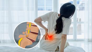 환절기 요통, 척추분리증의 경고일 수도…방치하면 척추 불안정증 키운다