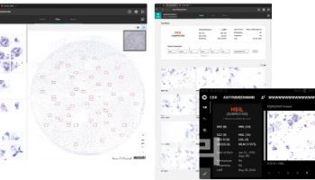 노을 ‘마이랩 CER’ 기술력 우려…선진 시장서 통할까?