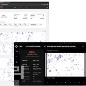 노을 ‘마이랩 CER’ 기술력 우려…선진 시장서 통할까?
