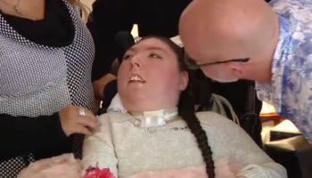 뇌 없이 태어나 '20번째' 생일...'기적'은 있나