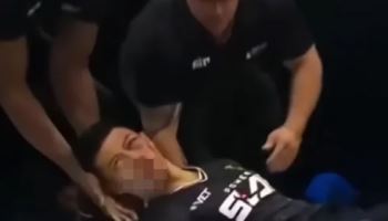 '따귀 대회' 나간 中 무술가, 한 방에 KO "광대뼈 골절"