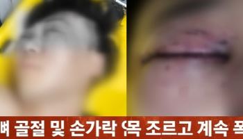 “살려주세요” 애원에도…“알게 뭐냐” 행인 목 조른 20대