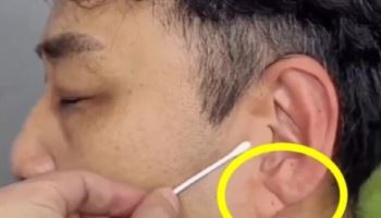 '심정지' 김수용...전조 있었다? 귓불에 이것 뭐길래