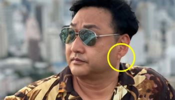 '심정지' 김수용...전조 있었다? 귓불에 이것 뭐길래