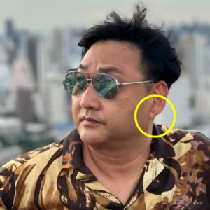 '심정지' 김수용...전조 있었다? 귓불에 이것 뭐길래