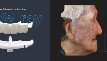 "무치악 치료 디지털로 완전 전환"…레이, 레이이트레이 출시