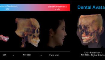 레이, 올해 연간 흑자전환 점쳐지는 이유