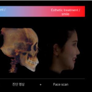 레이, 올해 연간 흑자전환 점쳐지는 이유