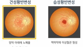 바이오 M&A 급증, 와이투솔루션 美 자회사 관심받는 이유