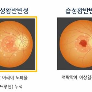 바이오 M&A 급증, 와이투솔루션 美 자회사 관심받는 이유