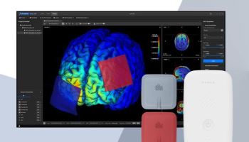 뉴로핏, 삼성서울병원에 ‘개인 맞춤형 tDCS 솔루션’ 국내 첫 공급