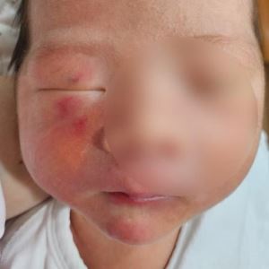 생후 4일 아기 얼굴에 상처…CCTV 없는 신생아실서 무슨 일