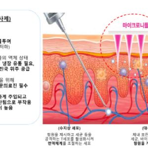 라파스, 마이크로니들 비만패치 SC제형 반감기 넘었다..."기술 수출 기대 UP"
