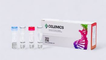 Celemics hits limit before after hours filing[K-Bio Pulse]