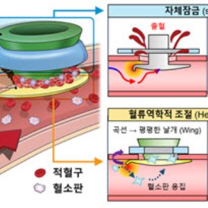 혈류 조절해 스스로 혈관 봉합하는 폐쇄장치 개발