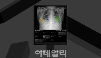 루닛, 원격영상판독 센터에 AI 솔루션 공급…외주 분야로 확장