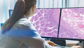 루닛, 해리슨AI 플랫폼에 결합...美 등 해외시장 확대 '청신호'[only 이데일리]