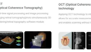 광학기술로 사업 영역 '무한 확장'…디지털 덴티스트리로 승부수[휴비츠 대해부②]
