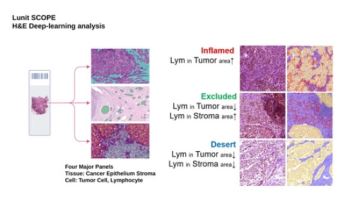 루닛·뷰노 등 K-의료AI기업 차별화 전략은[빅테크 의료AI 잠식위기 下]