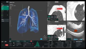 코어라인소프트, 독일 샤리테 대학병원에 흉부진단 AI 공급…실사용 확대