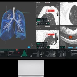 코어라인소프트, 독일 샤리테 대학병원에 흉부진단 AI 공급…실사용 확대
