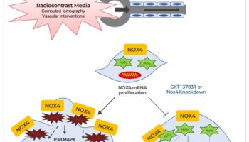 환자수 줄인 압타바이오, 임상 속도전…아이수지낙시브 기술수출 '승부수'