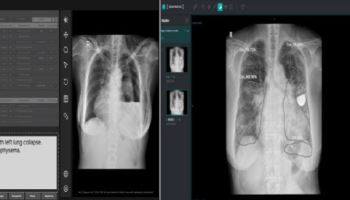 美 FDA도 못 뚫은 '생성형 AI' 의료기기… 韓 세계 최초 승인[AI헬스케어]