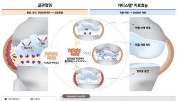日3상 결과공개 임박한 ‘카티스템’…메디포스트 주가도 고공행진