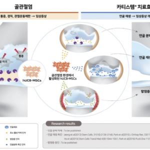 日3상 결과공개 임박한 ‘카티스템’…메디포스트 주가도 고공행진