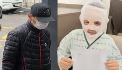교도소 면회도 왔는데...'끓는 물 부은 남편'에 마음 바뀐 아내