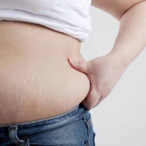 "체중보다 뱃살이 치명적"...의료진이 'BMI 25' 고수하는 이유