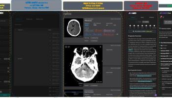 제이엘케이, 의료영상 특화 LLM 플랫폼 론칭...CT·MRI 분석