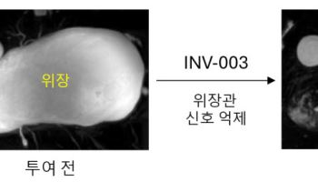 인벤테라, 경구용 MRCP 조영제 비임상 패키지 완성…연내 IND 제출