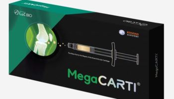 L&C Bio MegaCarti knee cartilage benefits hold for 4 years
