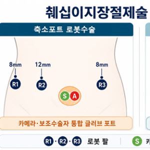 고난도 로봇 췌십이지장절제술,  절개 구멍 줄이면서 수술시간도 단축